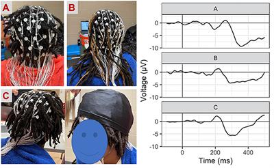 Dynamic cognitive inhibition in the context of frustration: Increasing racial representation of adolescent athletes using mobile community-engaged EEG methods